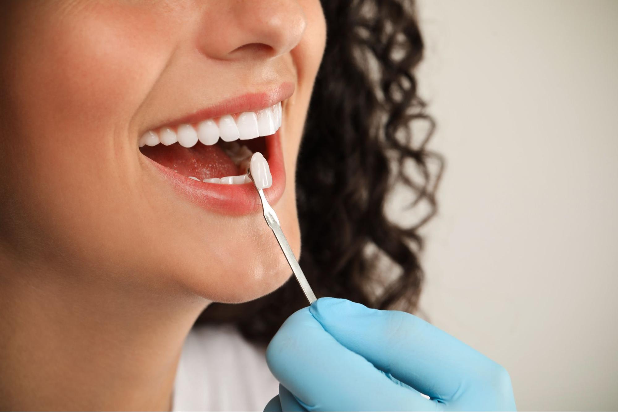 How Long Do Dental Implants Last and How To Care for Them